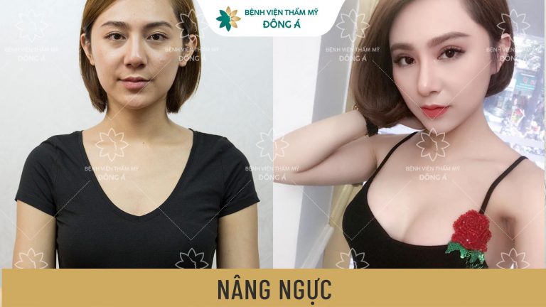 NÂNG NGỰC TÚI NANO – CHUẨN SIZE, TRÒN DÁNG, CẢM GIÁC NHƯ THẬT